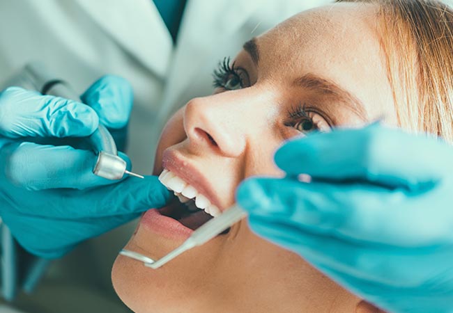 las claves del blanqueamiento dental