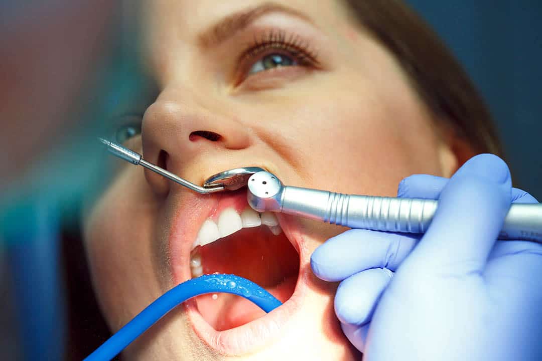 Consejos para prevenir enfermedades periodontales