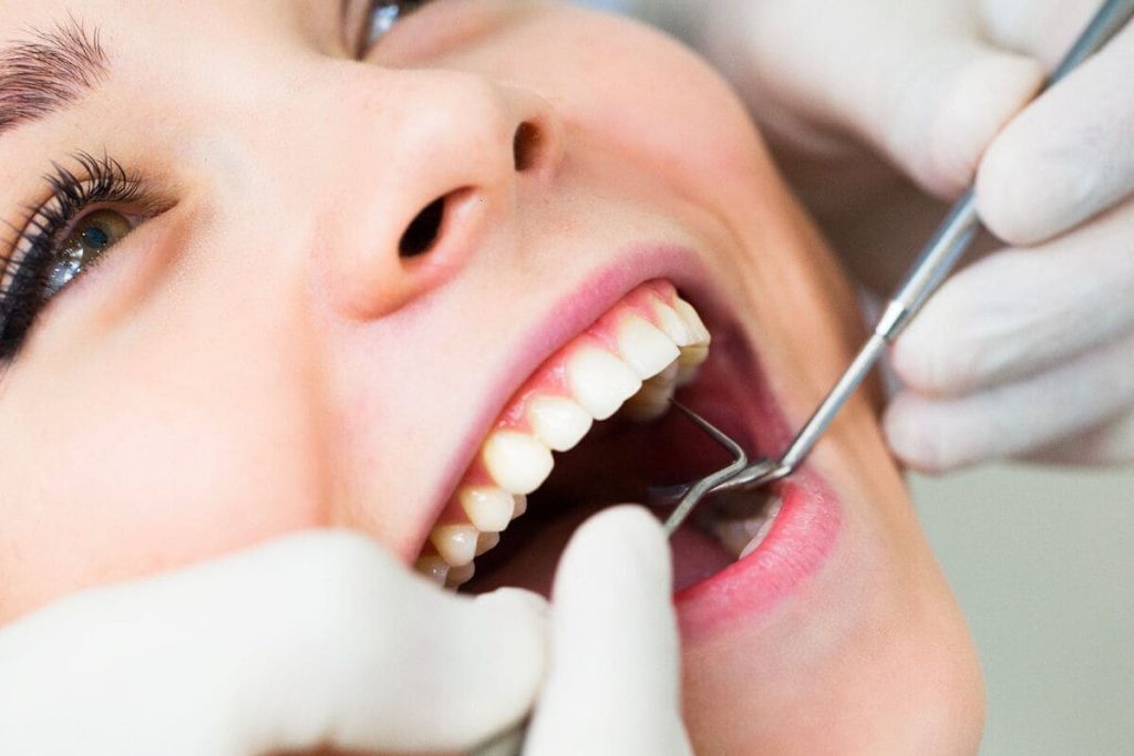 Dente Raspado Qué es un raspado dental y por qué podría necesitarlo | DentalQuality
